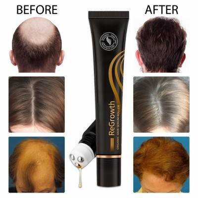 Regrowth Organic Hair Serum Roller Set, Hair Care Anti Stripping Liquid 20ml